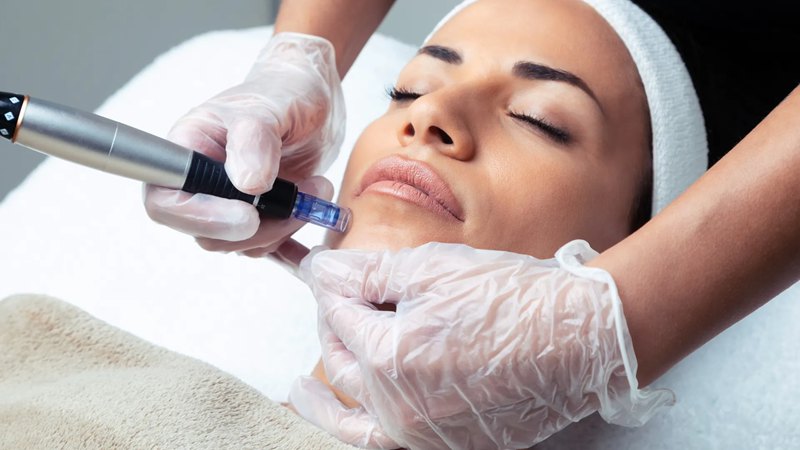 Consult professionals