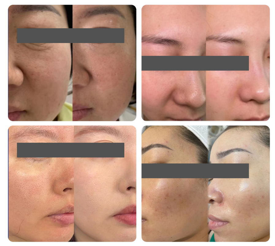 EXOBLOOM&reg;exosomes skincare