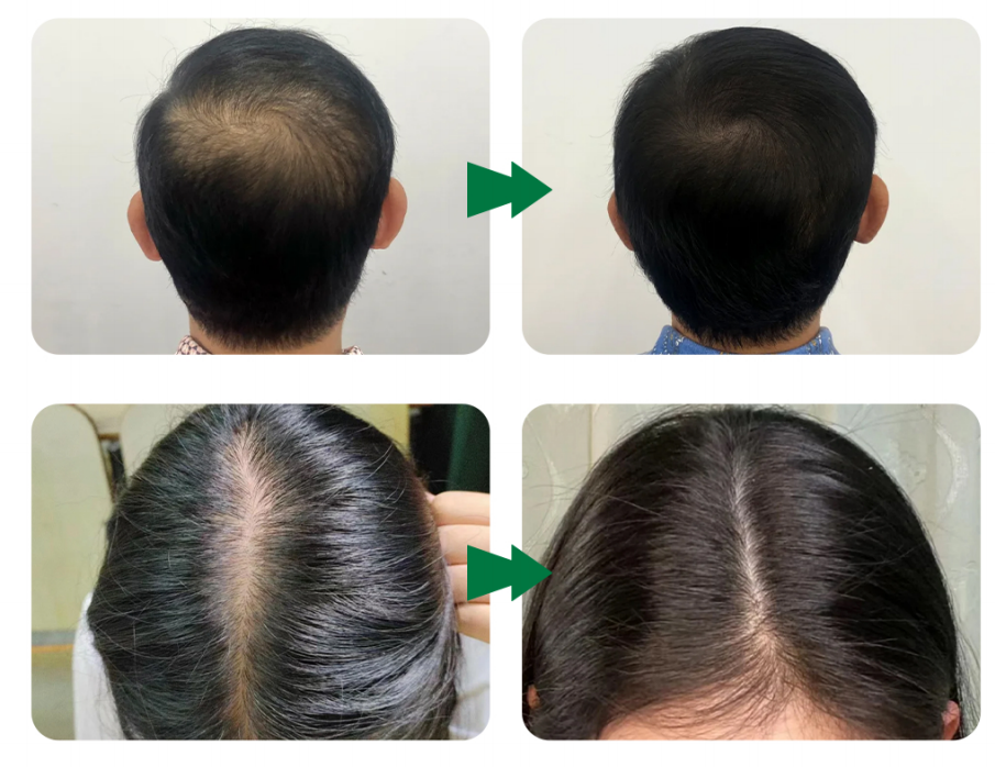 EXOBLOOM&reg; Scalp Care