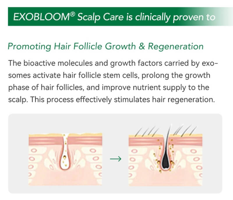 exosomes for hair loss