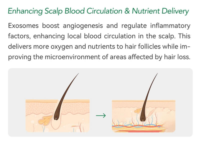 exosomes for hair loss