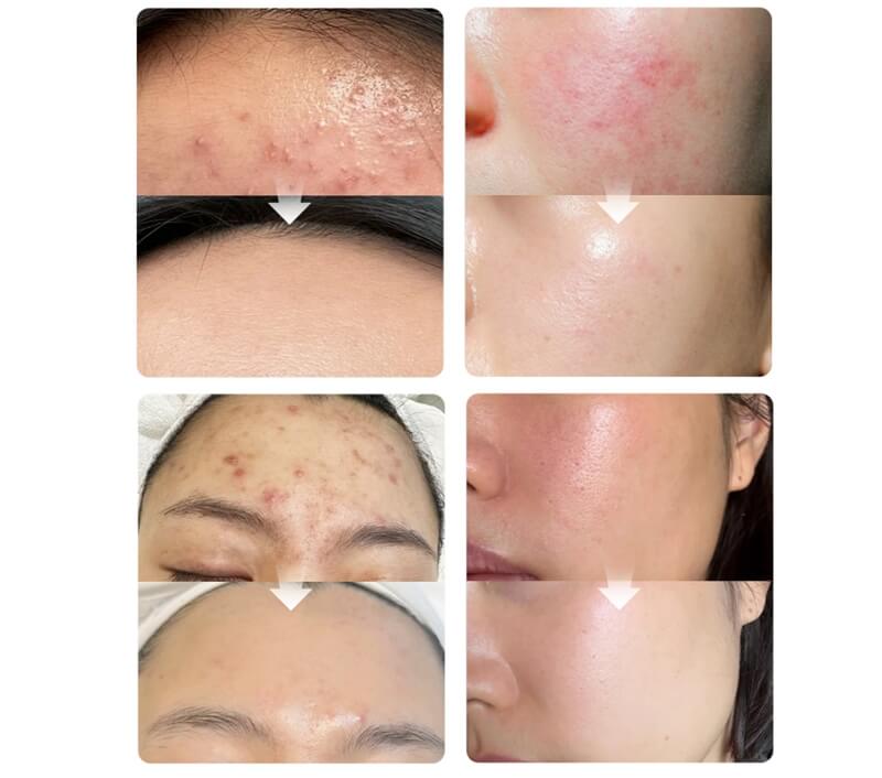 exosome face product