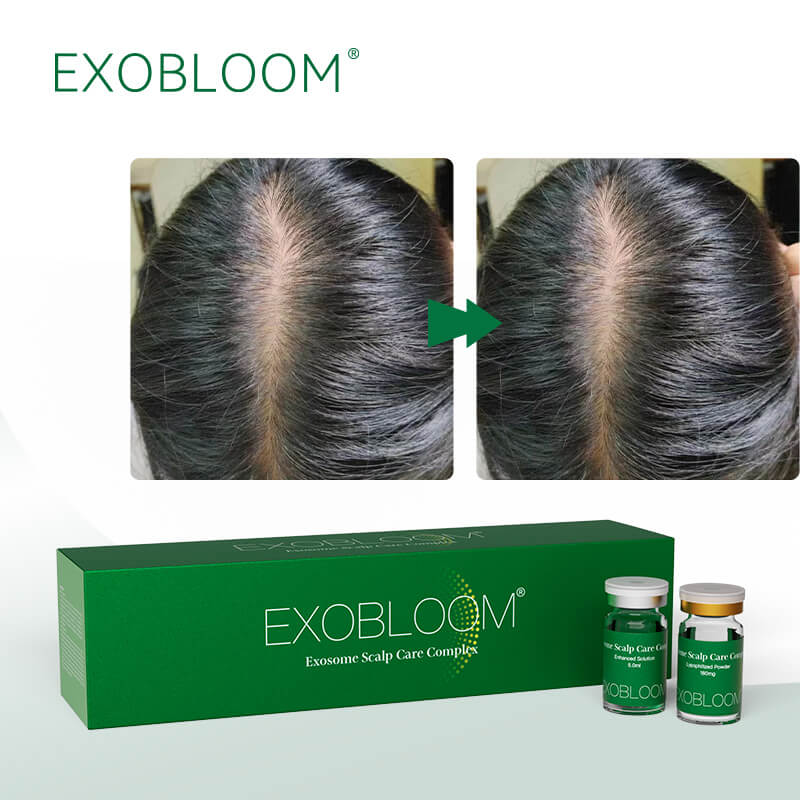 EXOBLOOM&reg; Scalp Care