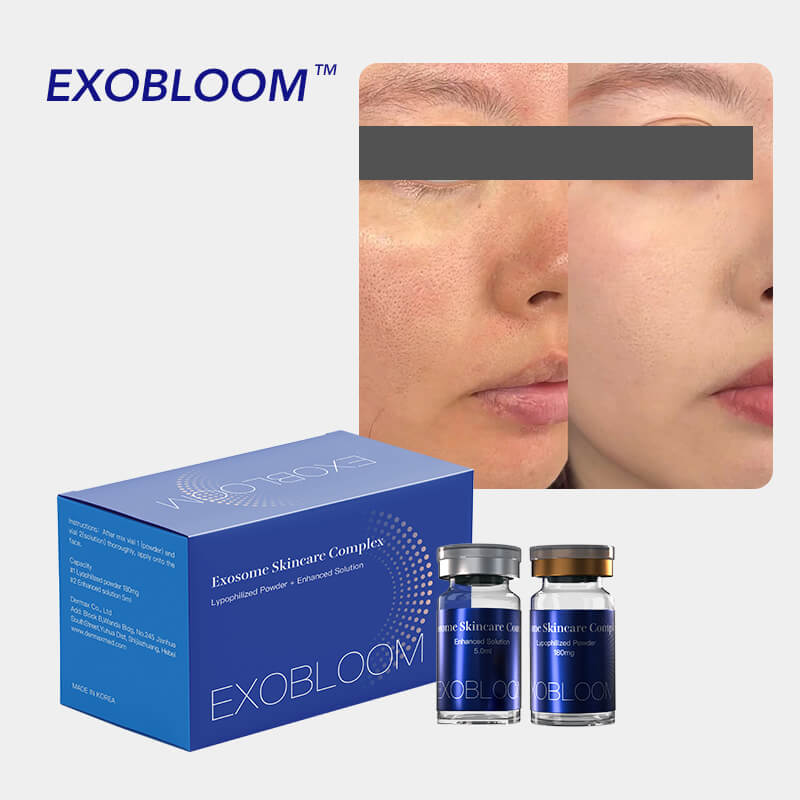 EXOBLOOM®
