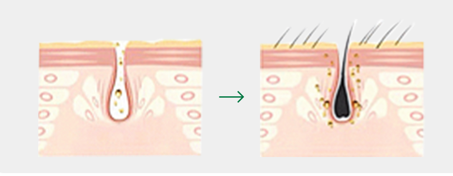 EXOBLOOM®