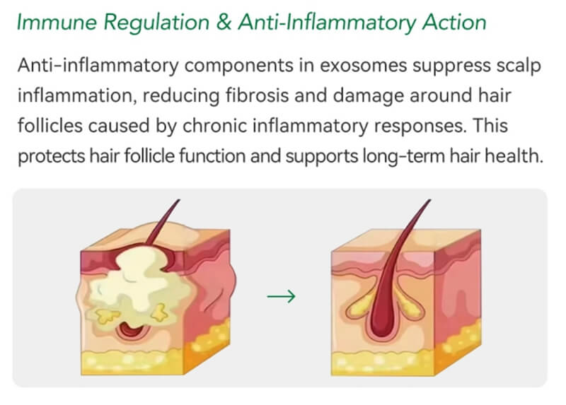 exosomes for hair loss