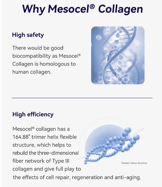 why Mesocel Type Ⅲ Collagen Injection why Mesocel Type Ⅲ Collagen Injection